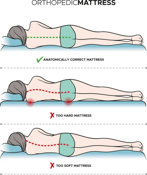 女性躺在床垫上的病媒图片 骨科床垫 正确和不正确的睡眠姿势 — 图库矢量图片