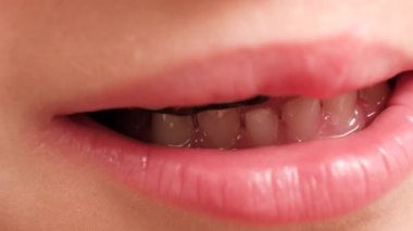 A close-up of a child's smile. Teeth with a replacement orthodontic plate to align the teeth