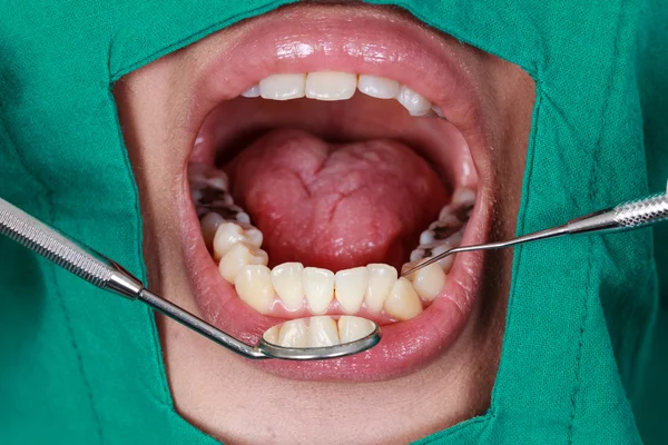 Стоматологическое лечение у дантиста — стоковое фото