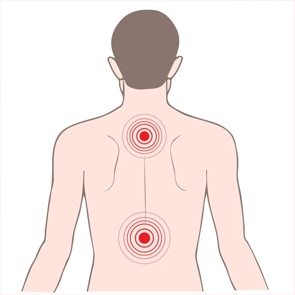 Ból pleców i szyi — Wektor stockowy