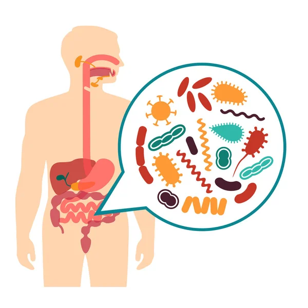 Ilustrare vectorială medicală a durerii de stomac, probleme ale sistemului digestiv uman — Vector de stoc