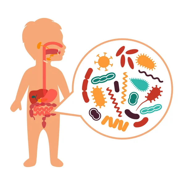 Illustration vectorielle médicale de maux d'estomac, Problèmes du système digestif des enfants — Image vectorielle