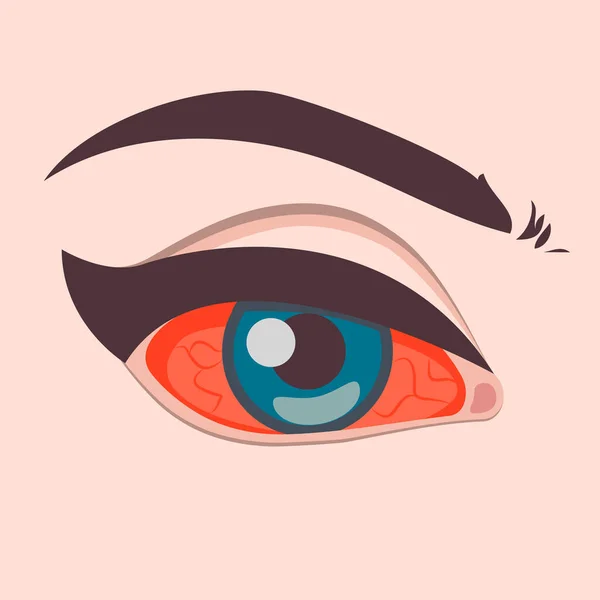 Trastorno de los ojos, dolor de ojos, ojos enrojecidos inflamados, icono de ojos rojos. Ilustración vectorial — Vector de stock
