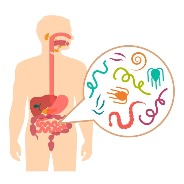 Ilustración vectorial de parásitos intestinales humanos, enfermedad del gusano — Vector de stock