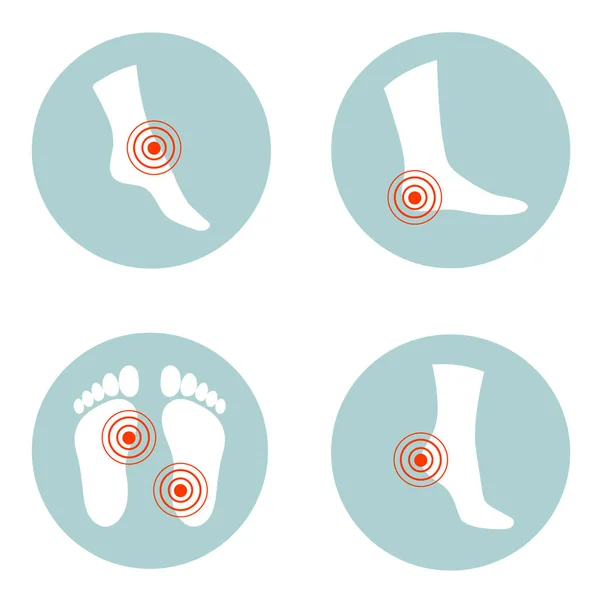 Diseño plano de un concepto de cuidado de la salud, Dolor y lesiones en partes del cuerpo. mujer está sintiendo dolor en los pies, tobillos y dedos de los pies. — Vector de stock