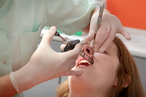 Procedura dentale — Foto Stock