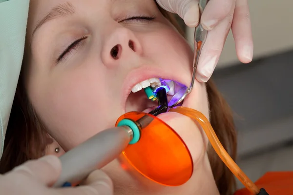 牙科手术、 激光 — 图库照片