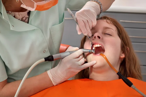 Procedura dentale, lucidatura dei denti — Foto Stock