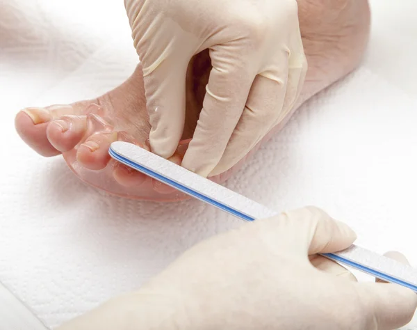 Photos of foot nail varnishing process, series of photos — Stock Photo, Image