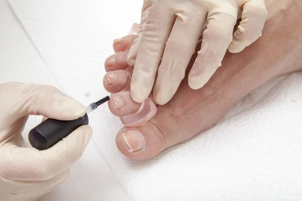 Photos of foot nail varnishing process, series of photos — Stock Photo, Image