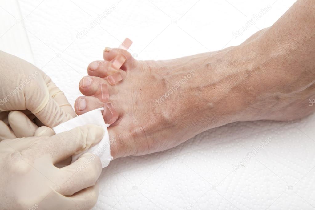 Photos of foot nail varnishing process, series of photos