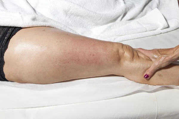 Belleza y Anti masaje de celulitis — Foto de Stock