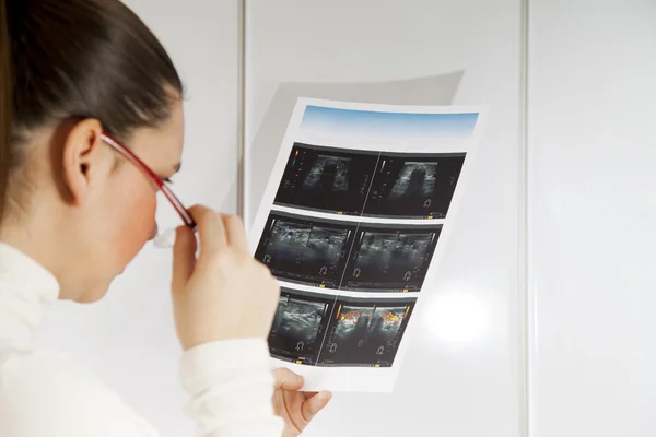 Médico que verifica a fotografia do ultrassom da tiróide — Fotografia de Stock