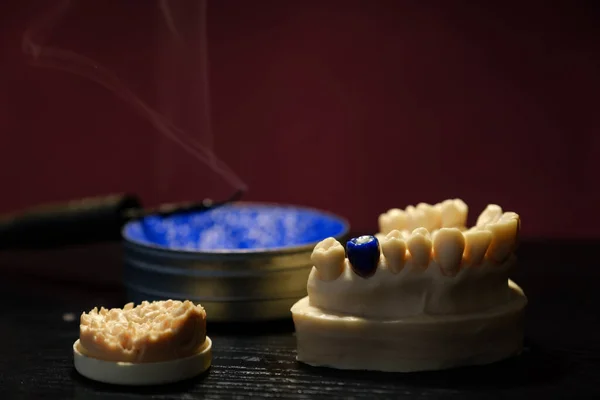 Trabajo Técnico Dental Producción Prótesis Bodegón Dental Modelo Mandíbula Superior — Foto de Stock