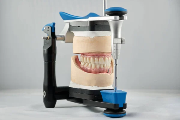 Dental photo of the articulator and two dental prostheses in the occlusion for accuracy and measurements. The concept of prosthetics and implantology.