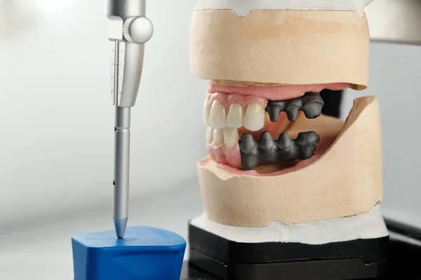 Dental Photo Articulator Two Dental Prostheses Occlusion Accuracy Measurements Concept —  Fotos de Stock