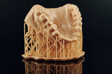 3D Printing Dental Crowns and Bridge Models. Orthodontic model for dental. The concept of prosthetics and implantology.