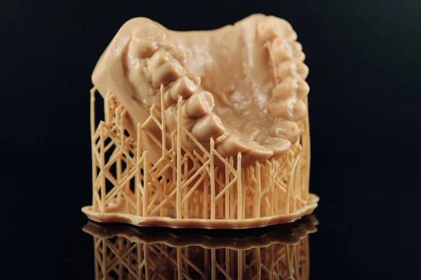3D Printing Dental Crowns and Bridge Models. Orthodontic model for dental. The concept of prosthetics and implantology.