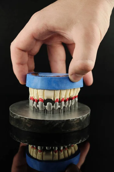牙科技师在实验室检查他的工作 三维金属打印机上的牙冠 — 图库照片