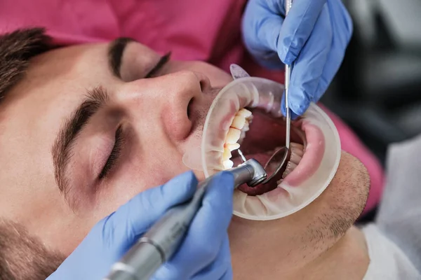 Una Dentista Femenina Trata Caries Dental Los Dientes Paciente Masculino Fotos De Stock