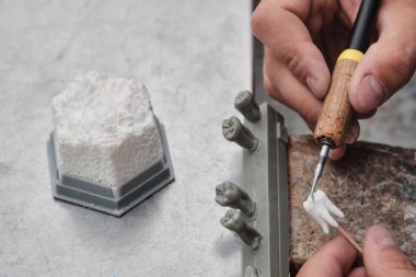 Diş teknisyeni, takma dişleriyle laboratuarında çalışıyor. Balmumuyla, yakın plan. Diş teknisyeni diş modelliği taçlarını sıcak balmumuyla kaplıyor..