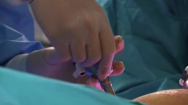 Medical Surgical Using Devices Operation — Video Stock