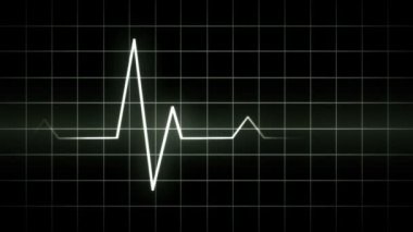 EKG ekranı