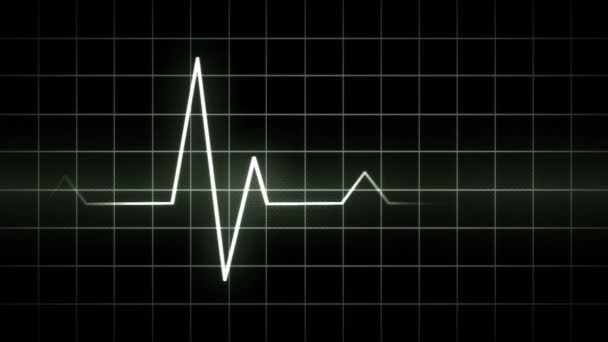 Visualizzazione ECG — Video Stock