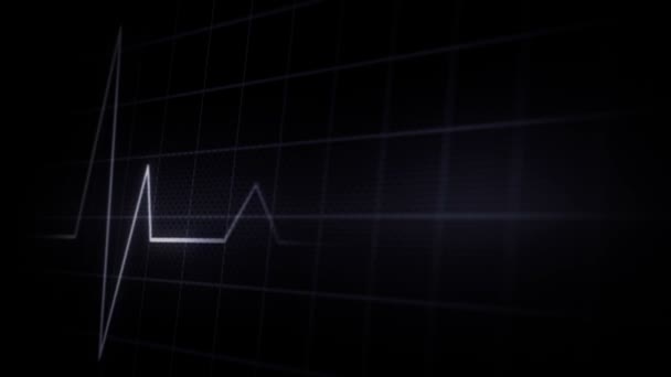 Pantalla ECG — Vídeos de Stock