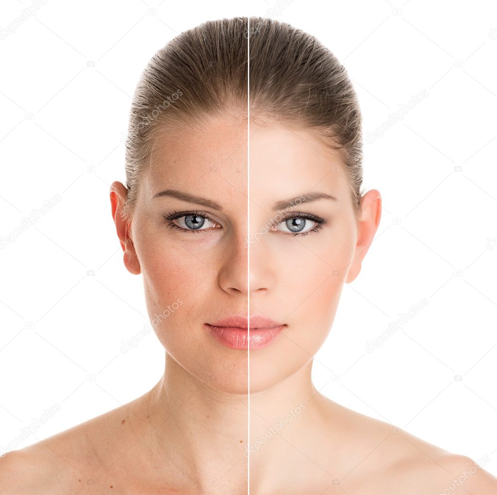 Cosmetic surgery woman