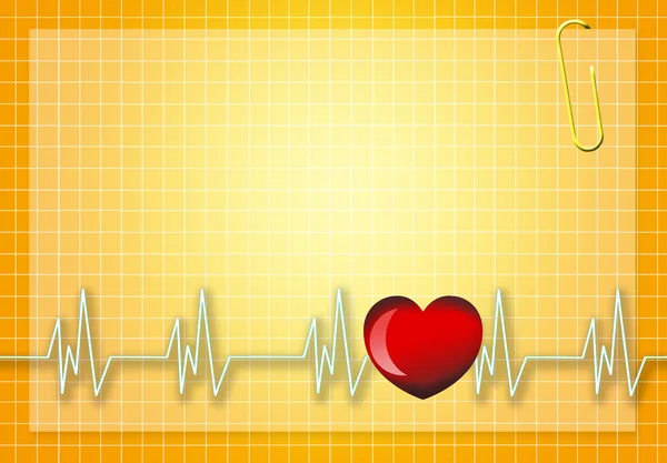 Electrocardiograma — Foto de Stock