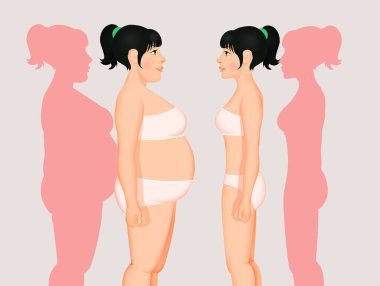 illustration of obese girl after diet