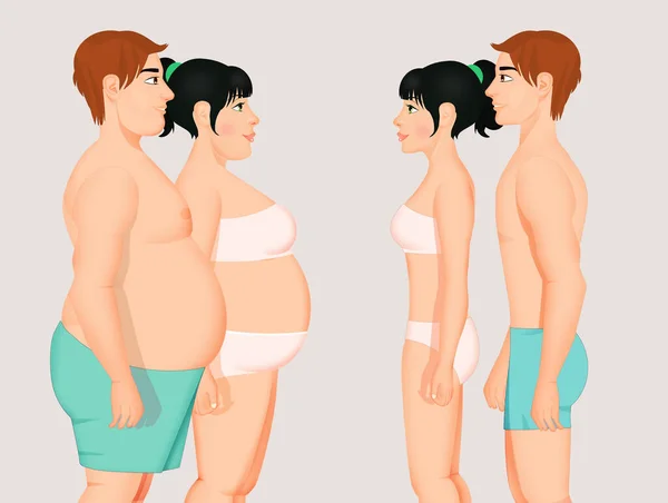 Ілюстрація Ожиріння Пари Після Дієти — стокове фото