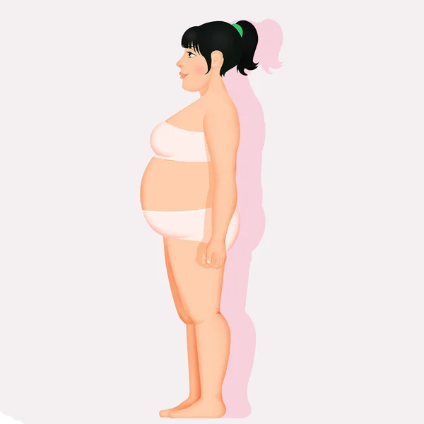 Απεικόνιση Της Παχύσαρκης Γυναίκας — Φωτογραφία Αρχείου
