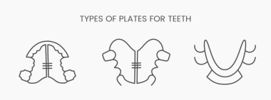 Diş plakalarının doğrusal simge tipleri. Diş kliniği için vektör illüstrasyonu.