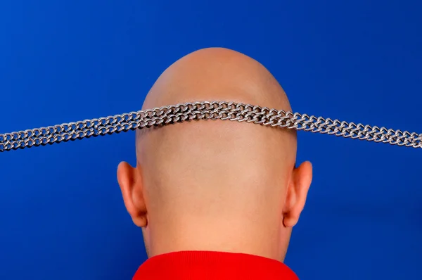 Baldness problem — Stock Photo, Image