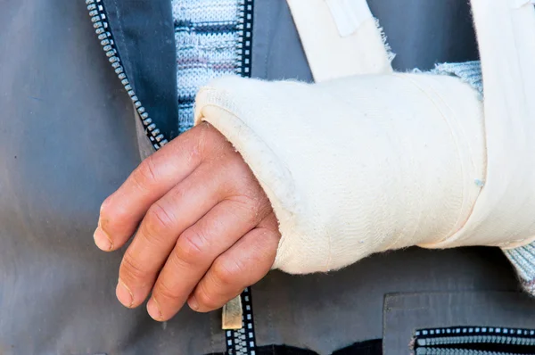 Gebroken hand — Stockfoto