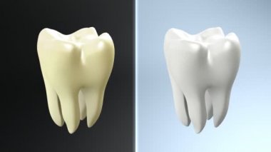 Diş Karşılaştır