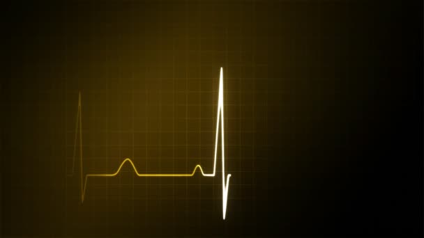 EKG monitor geld afbeelding — Stockvideo