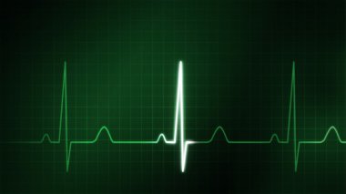 EKG'de İzleyicisi için tıbbi tema yeşil grafik