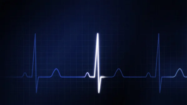 O gráfico azul do monitor EKG — Fotografia de Stock