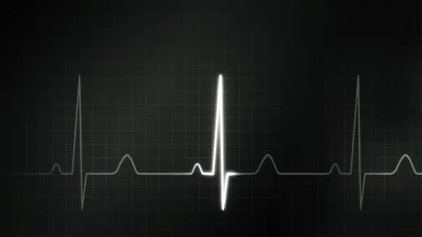 EKG'de İzleyicisi olan siyah-beyaz grafik — Stok fotoğraf