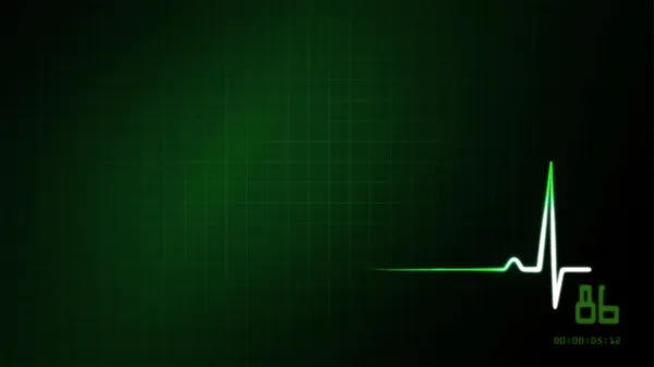 Green EKG monitor background — Stock Photo, Image