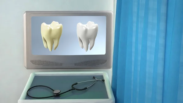 Dentes comparar sala médica closeup — Fotografia de Stock