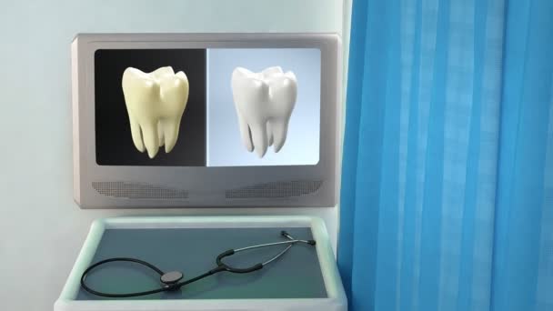 Zahnkontrastmedizinischer Bildschirm Nahaufnahme — Stockvideo