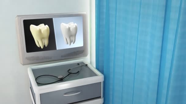 Schermo medico a contrasto dentale — Video Stock