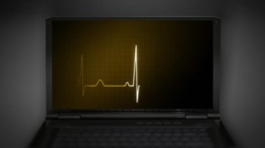 EKG'de İzleyicisi para grafik