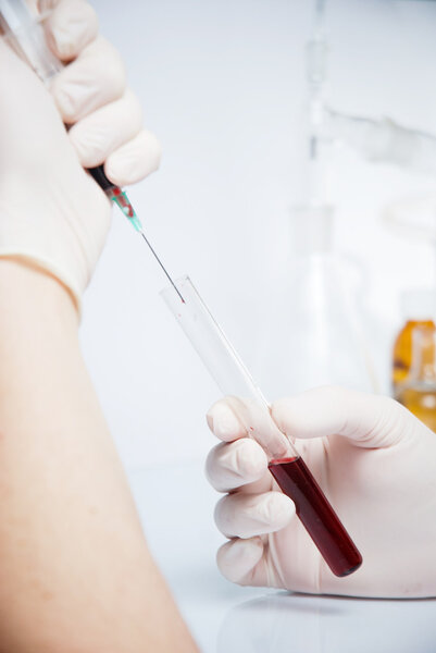 Test-tube with blue liquid isolated