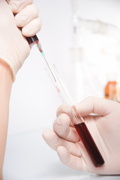 Doctor's hand in glove with blood