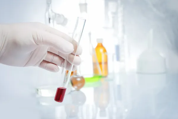 Doctor's hand in glove with blood — Stock Photo, Image